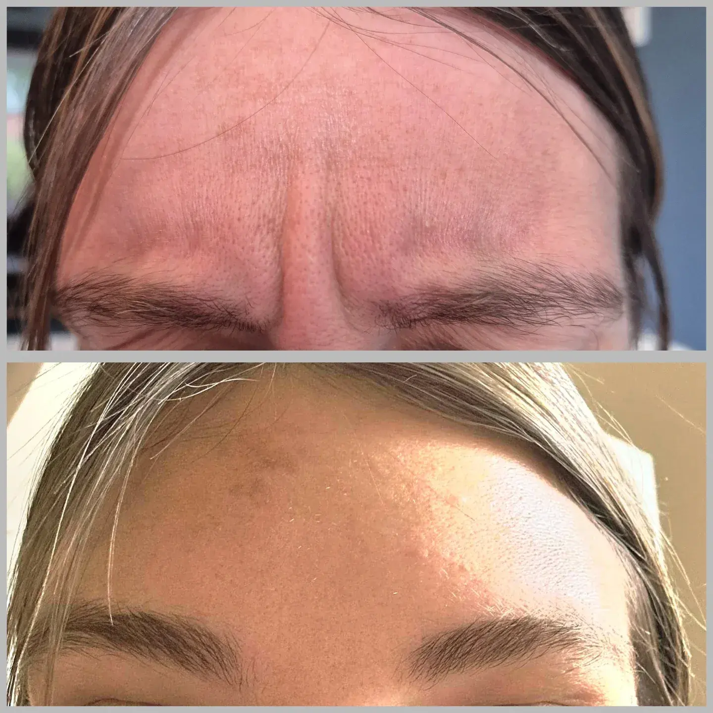 Anti-Wrinkle Session
